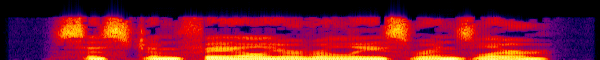 Audio spectrogram